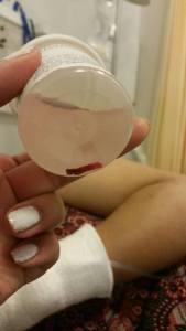 A piece of my bone marrow.. so much pain for something NOT so beautiful.